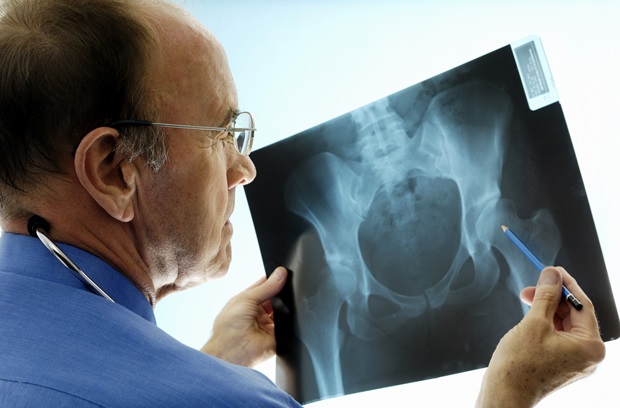 Doctor Looking At Hip Xray.ashx?mw=620&mh=408